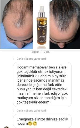 Dökülme Önleyici Saç Bakım Yağı Saç Çıkarıcı  Kök Uyarıcı Saçları Besleyen Uzatan Formül 150 Ml Argan Yağlı Saç Kopleksi